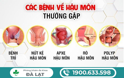 Hình ảnh minh họa